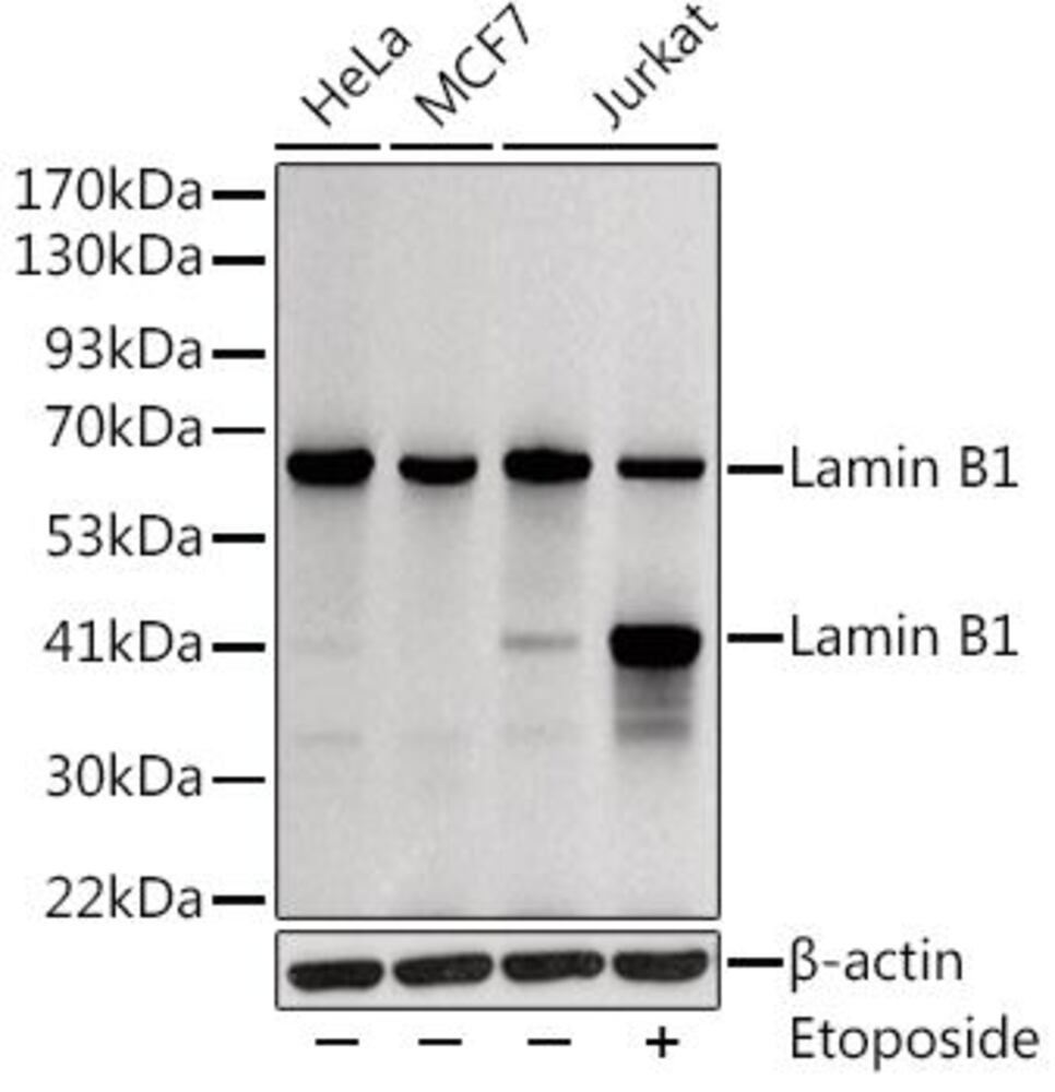 Anti-Lamin B1 Antibody, 100 µl - Luminix Health