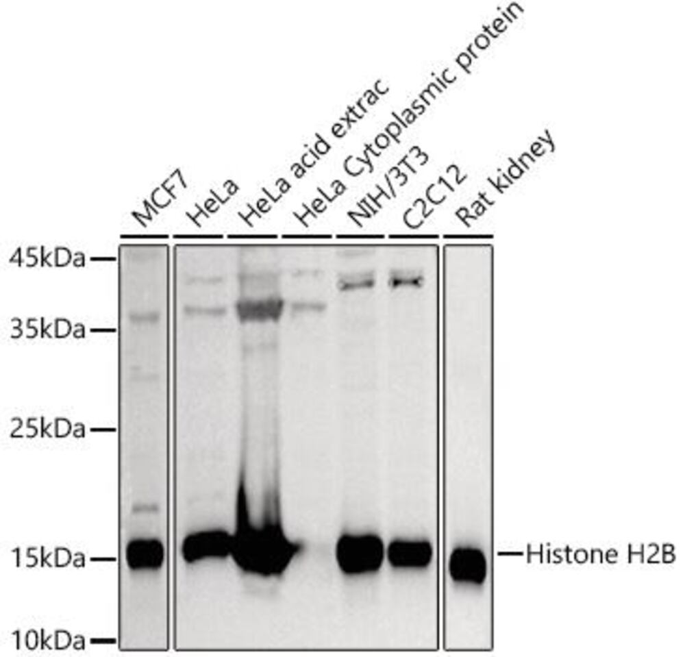 Anti-Histone H2B Antibody, 100 µl - Luminix Health