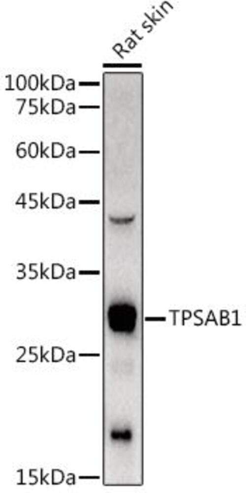 Anti-Mast Cell Tryptase Antibody, 100 µl - Luminix Health