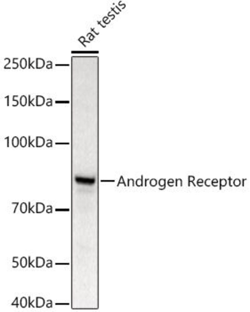 Anti-Androgen Receptor Antibody, 100 µl - Luminix Health