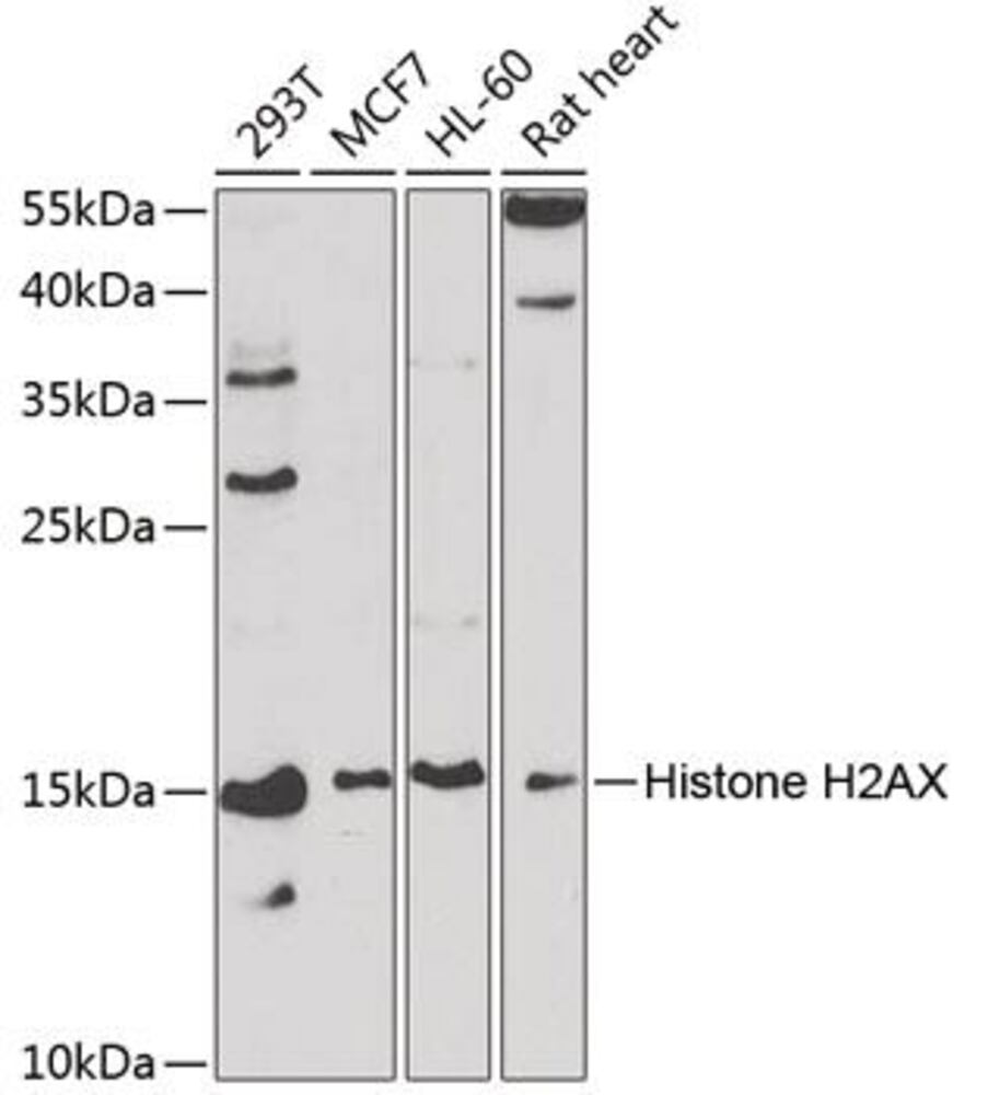 Anti-Histone H2A.X Antibody, 100 µl - Luminix Health
