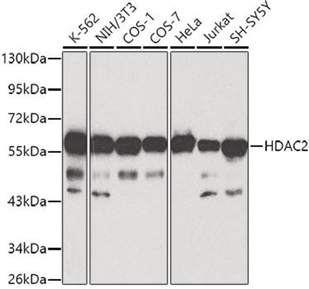 Anti-HDAC2 Antibody, 100 µl - Luminix Health