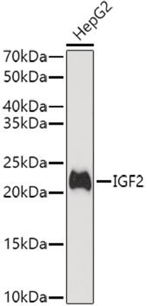 Anti-IGF2 Antibody, 100 µl - Luminix Health