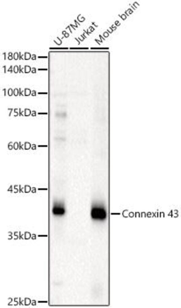 Anti-Connexin 43 / GJA1 Antibody - Luminix Health