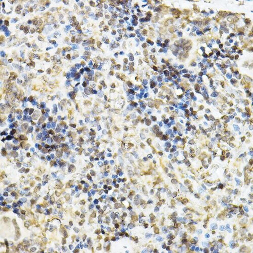 Anti-Glucocorticoid Receptor Antibody, 100 µl - Luminix Health