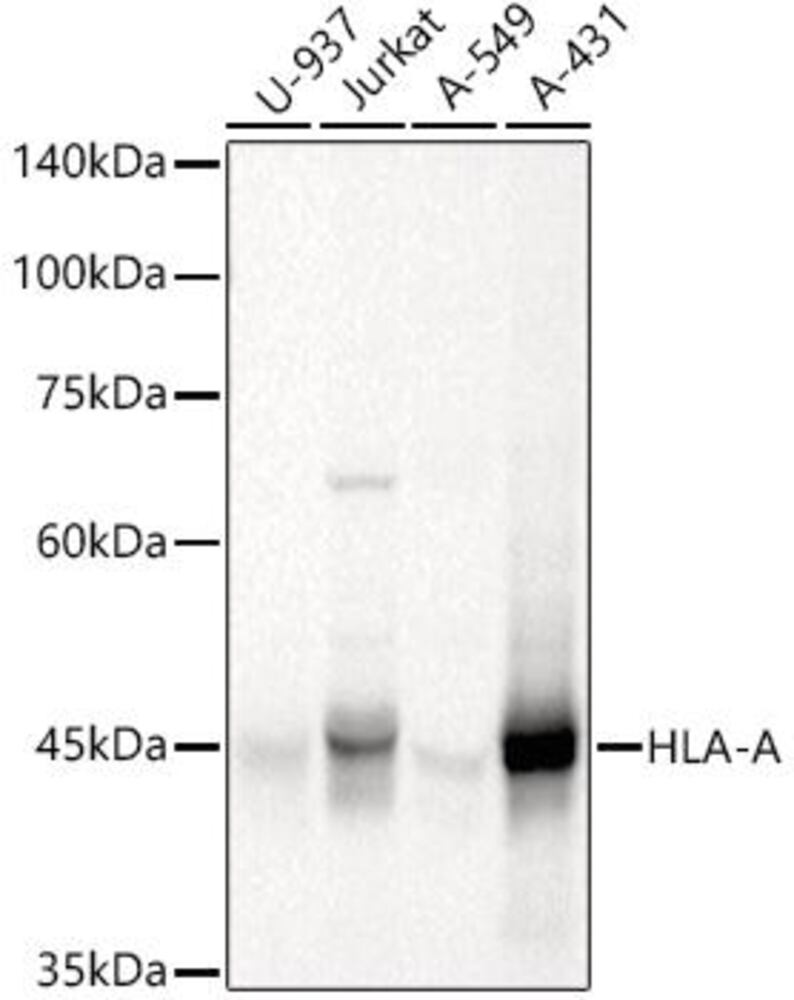 Anti-HLA-A Antibody ab196590), 100 µl - Luminix Health