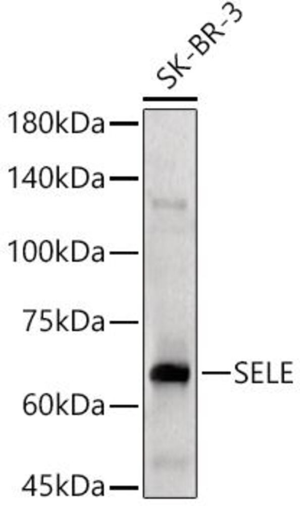 Anti-CD62E Antibody, 100 µl - Luminix Health