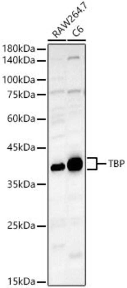Anti-TATA binding protein TBP Antibody, 100 µl - Luminix Health
