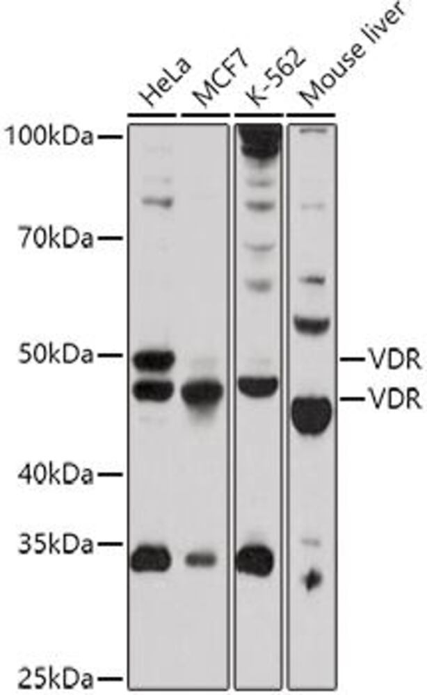 Anti-Vitamin D Receptor Antibody, 100 µl - Luminix Health