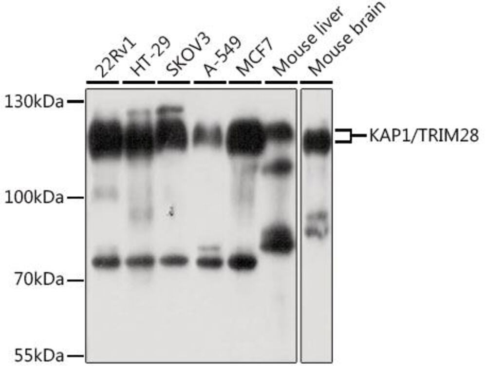 Anti-KAP1 Antibody, 100 µl - Luminix Health