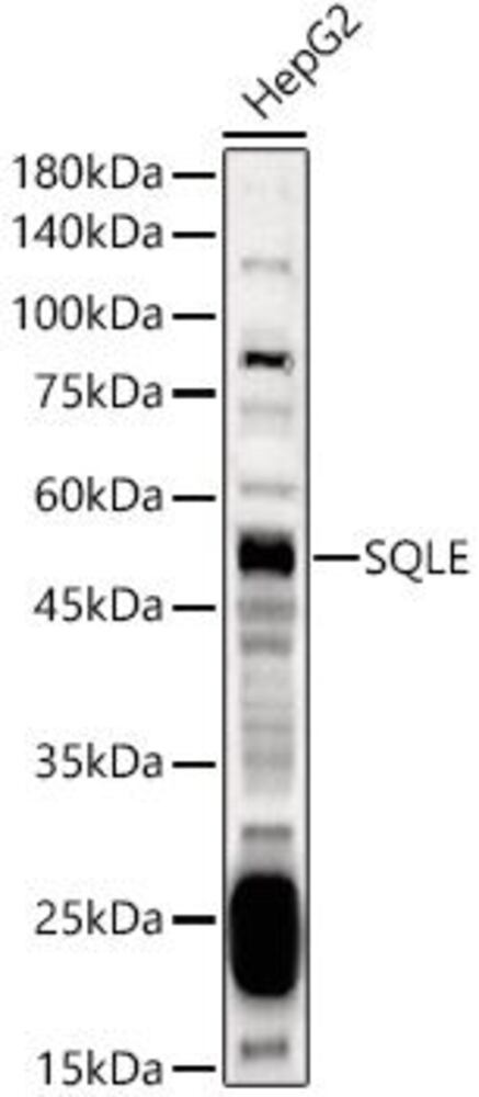 Anti-Squalene Epoxidase Antibody, 100 µl - Luminix Health