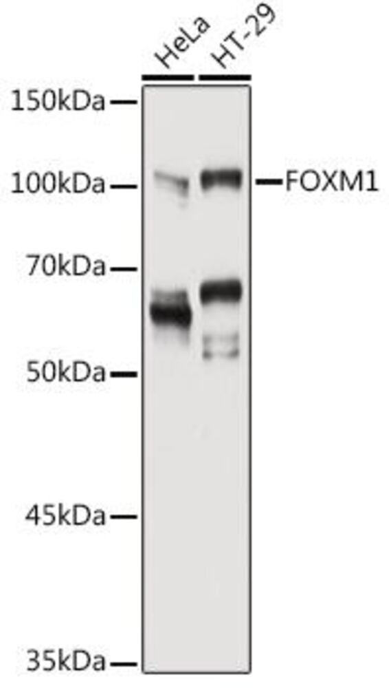 Anti-FOXM1 Antibody, 100 µl - Luminix Health