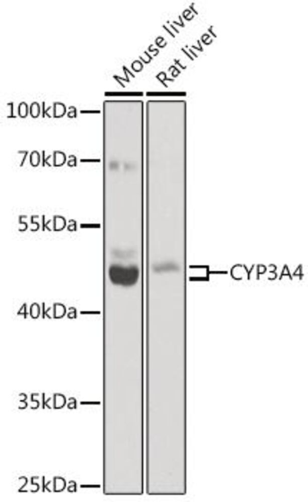 Anti-Cytochrome P450 3A4 / CYP3A4 Antib, 100 µl - Luminix Health