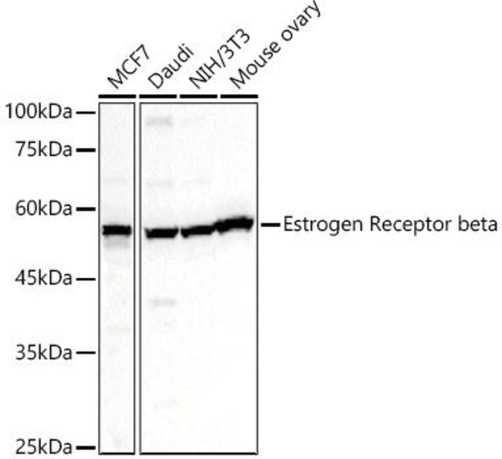 Anti-Estrogen Receptor beta Antibody, 100 µl - Luminix Health