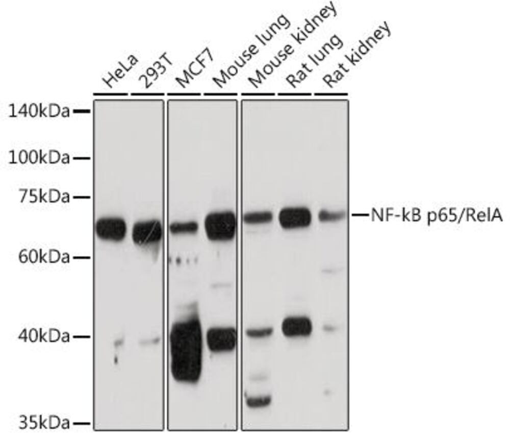 Anti-NF-kB p65 Antibody, 100 µl - Luminix Health