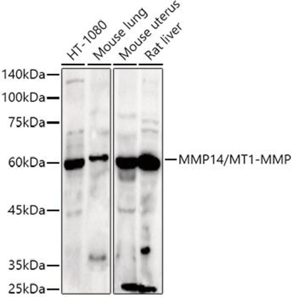 Anti-MMP14 Antibody, 100 µl - Luminix Health