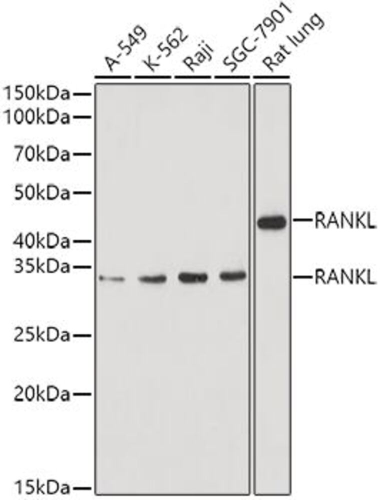 Anti-RANKL Antibody, 100 µl - Luminix Health