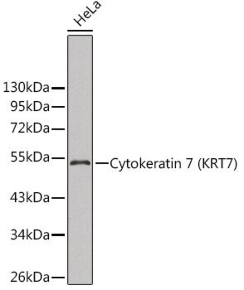 Anti-Cytokeratin 7 Antibody, Density (D) 1 g/cm³, Storage temp. +4 °C - Luminix Health