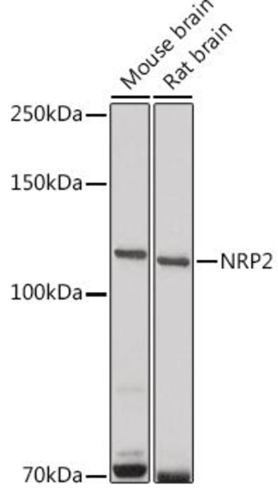 Anti-NRP2 Antibody ab185710), 100 µl - Luminix Health