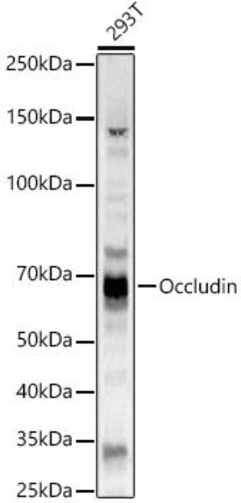 Anti-Occludin Antibody, 100 µl - Luminix Health