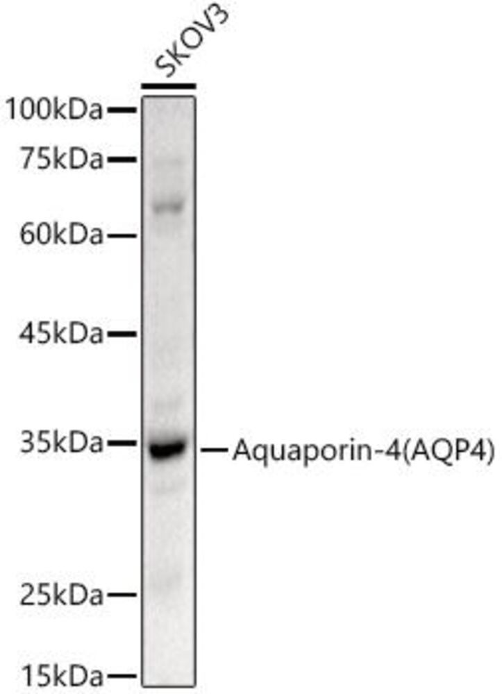 Anti-Aquaporin 4 Antibody, 100 µl - Luminix Health