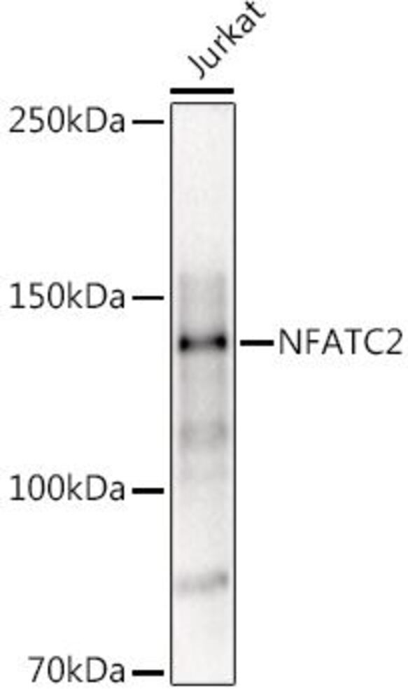 Anti-NFAT1 Antibody, 100 µl - Luminix Health