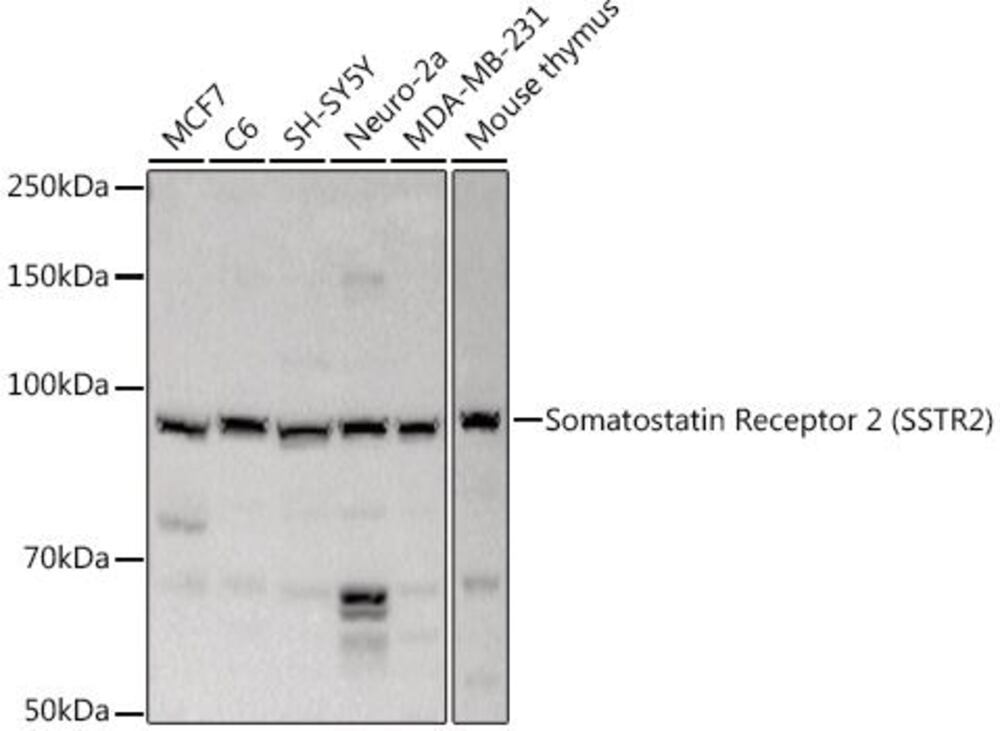 Anti-Somatostatin Receptor 2 Antibody, 100 µl - Luminix Health
