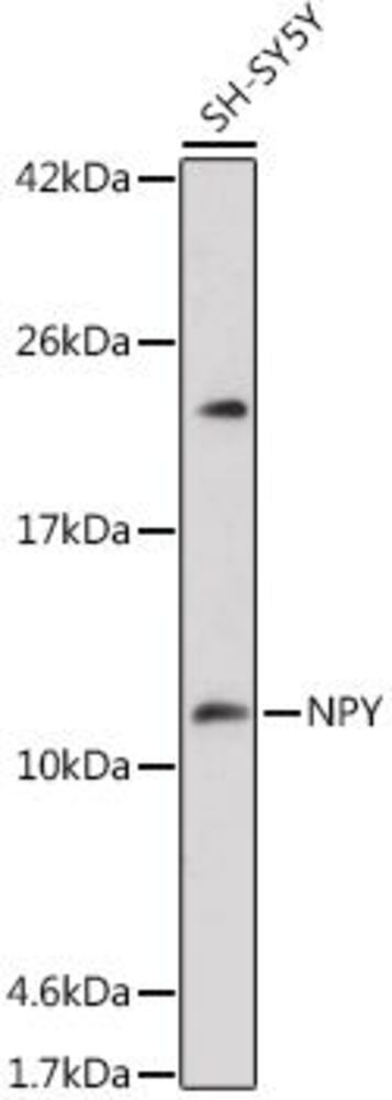 Anti-Neuropeptide Y Antibody, 100 µl - Luminix Health