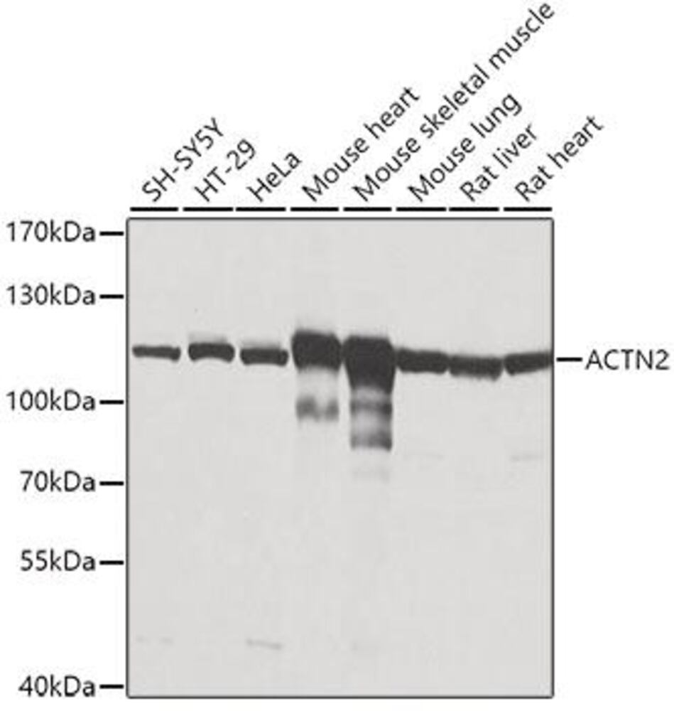 Anti-Sarcomeric Alpha Actinin Antibody, 100 µl - Luminix Health