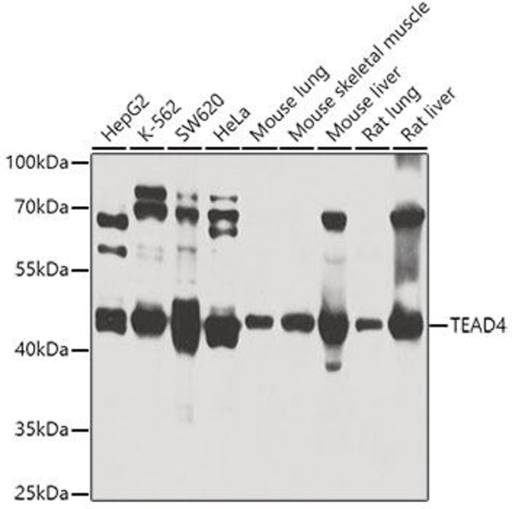 Anti-TEAD4 Antibody, 100 µl - Luminix Health