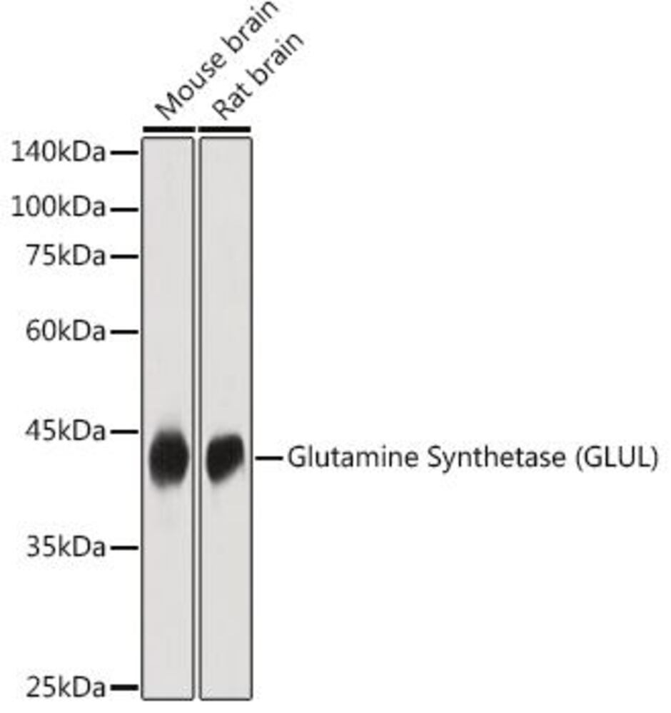 Anti-Glutamine Synthetase Antibody, Density (D) 1 g/cm³, Storage temp. +4 °C - Luminix Health