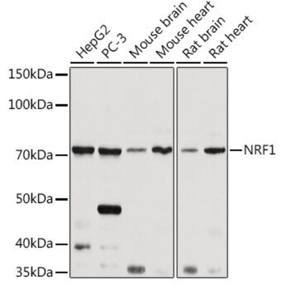Anti-NRF1 Antibody, 100 µl - Luminix Health