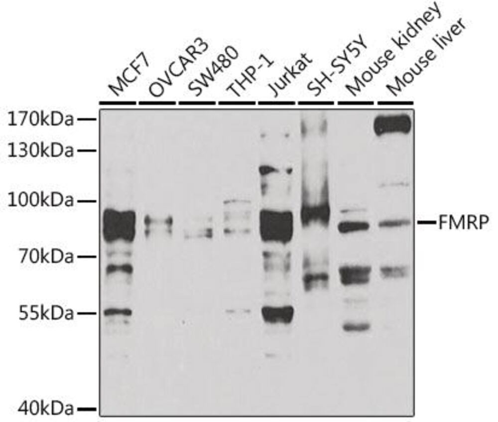 Anti-FMRP Antibody, 100 µl - Luminix Health
