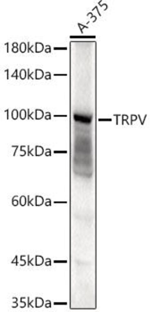 Anti-TRPV4 Antibody, 100 µl - Luminix Health
