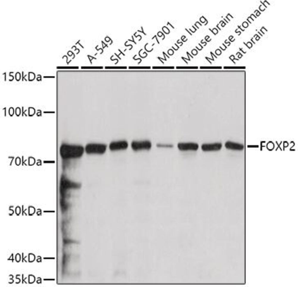 Anti-FOXP2 Antibody, 100 µl - Luminix Health