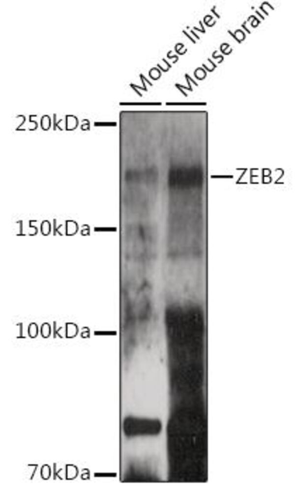 Anti-ZEB2 Antibody, 100 µl - Luminix Health