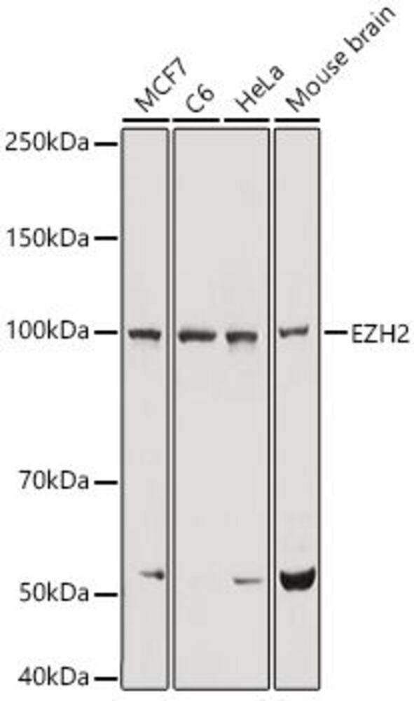 Anti-EZH2 Antibody, 100 µl - Luminix Health