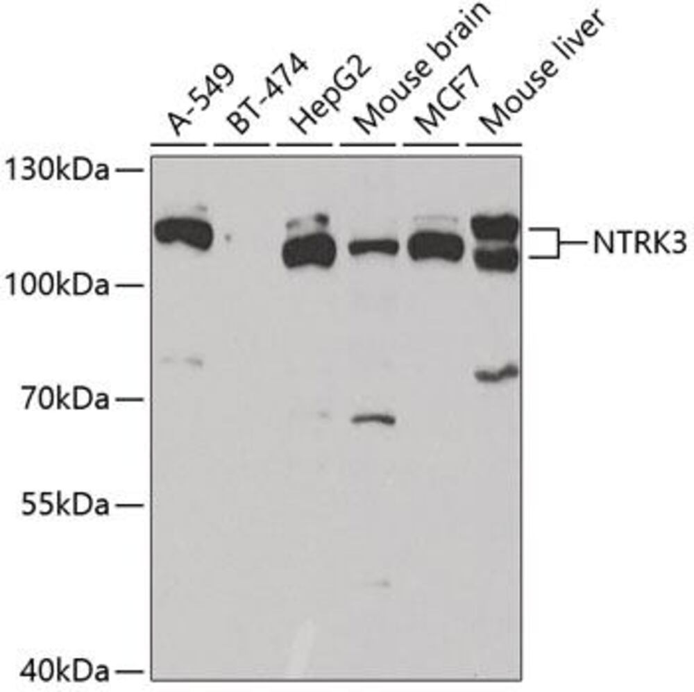 Anti-TrkC Antibody, 100 µl - Luminix Health