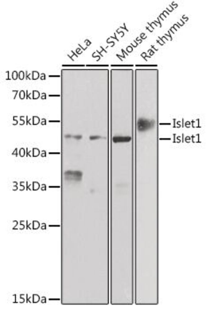 Anti-Islet 1 Antibody, 100 µl - Luminix Health