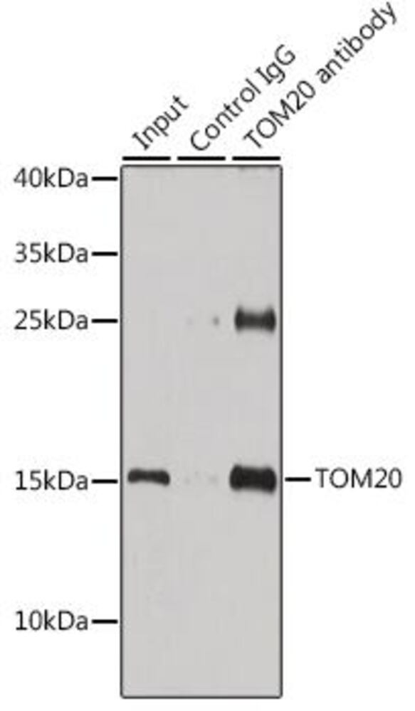 Anti-TOMM20 Antibody, 100 µl - Luminix Health