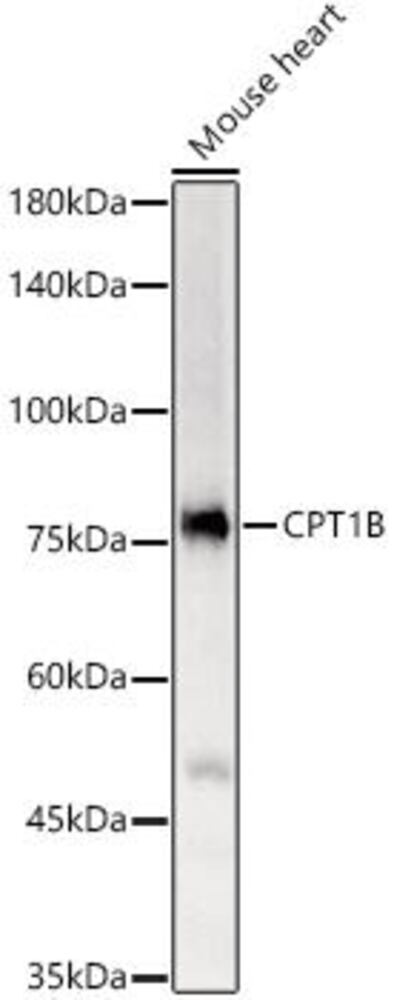 Anti-CPT1B Antibody, 100 µl - Luminix Health
