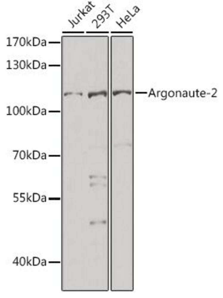 Anti-Argonaute-2 Antibody, 100 µl - Luminix Health
