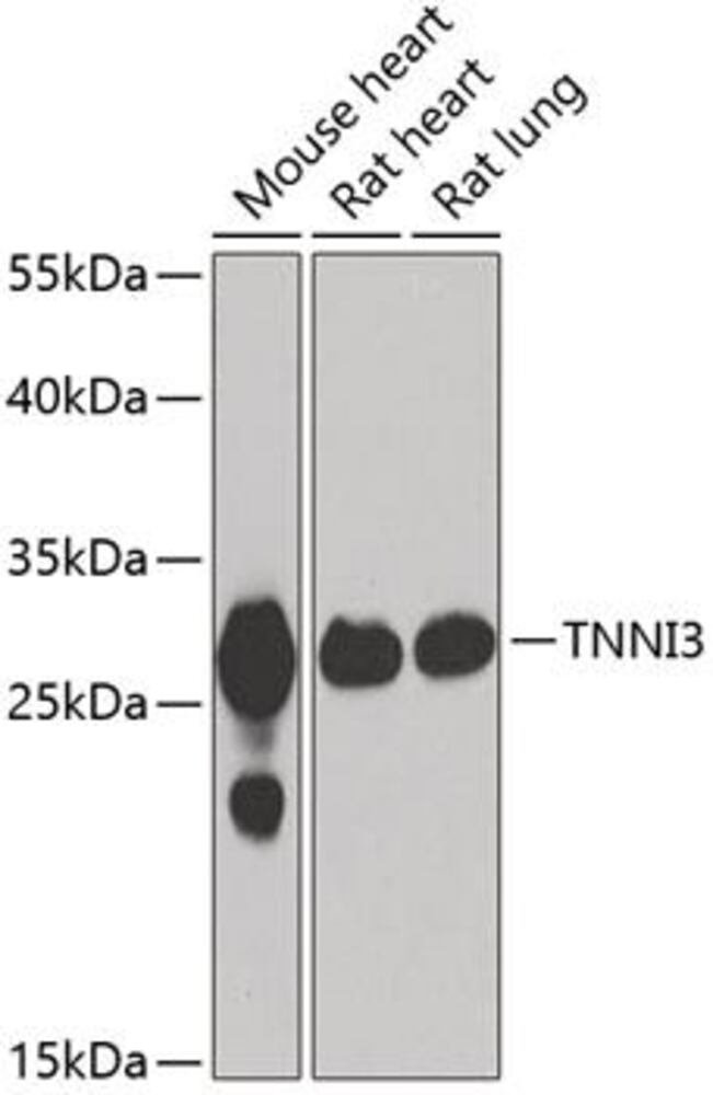 Anti-Cardiac Troponin I Antibody, 100 µl - Luminix Health