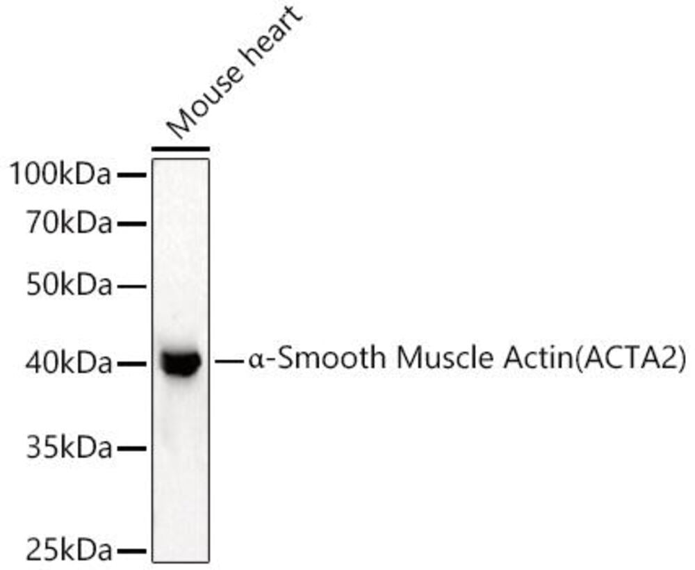 Anti-alpha smooth muscle Actin Antibody - Luminix Health