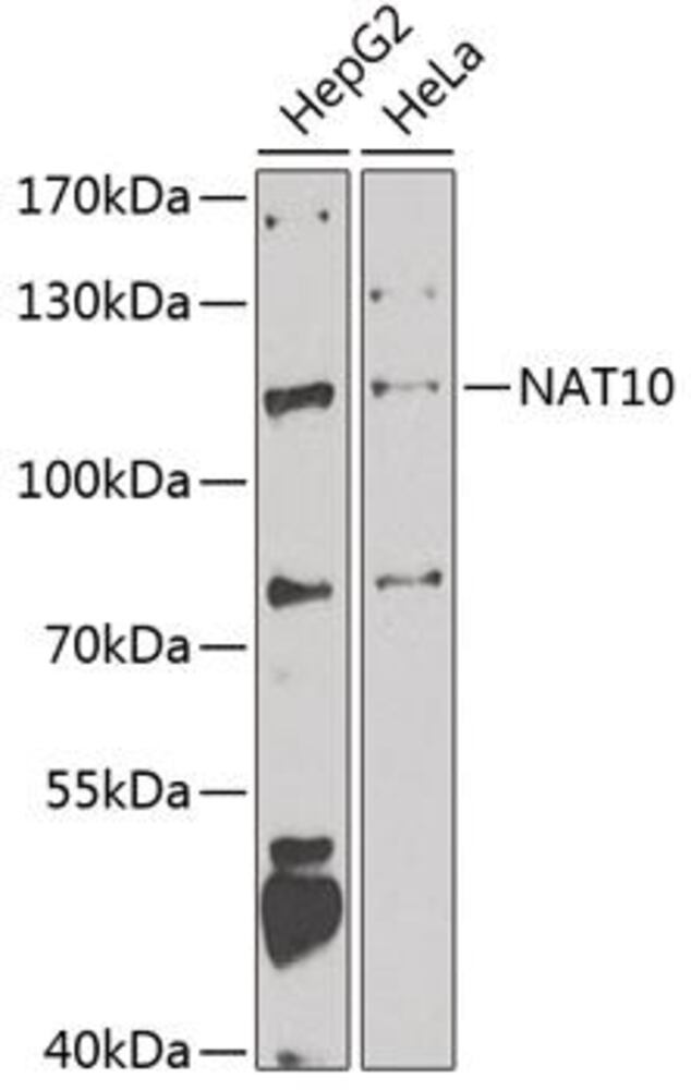 Anti-NAT10 Antibody, 100 µl - Luminix Health