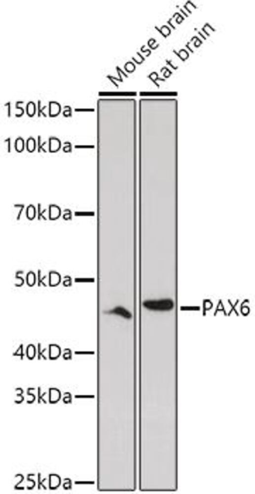 Anti-PAX6 Antibody, 100 µl - Luminix Health