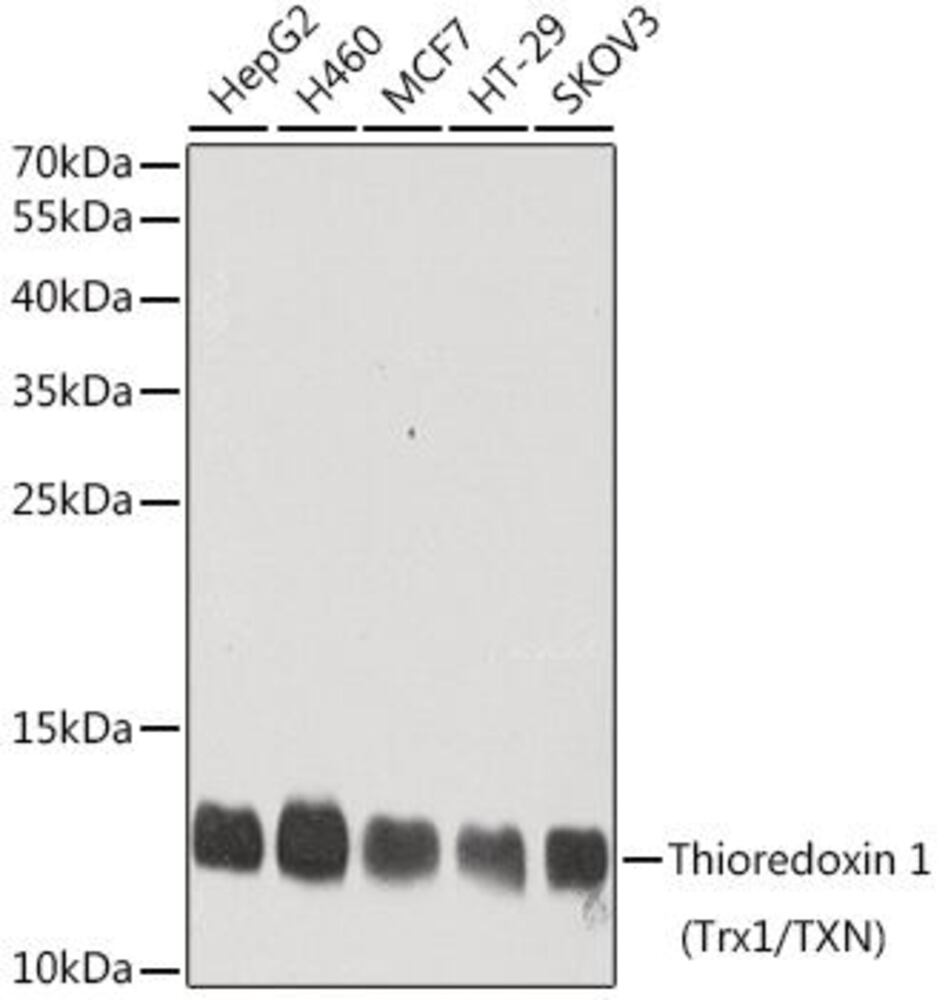 Anti-Thioredoxin / TRX Antibody, 100 µl - Luminix Health