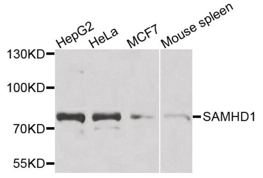 Anti-SAMHD1 Antibody, 100 µl - Luminix Health