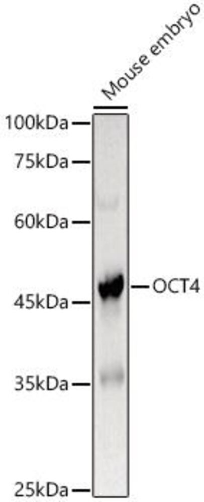 Anti-Oct4 Antibody, 100 µl - Luminix Health