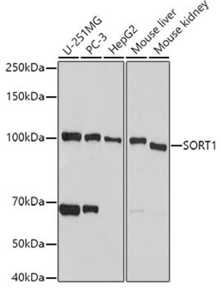 Anti-Sortilin / NT3 Antibody, 100 µl - Luminix Health
